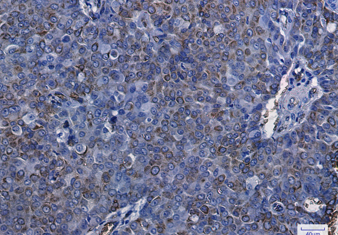 Aquaporin 1 Rabbit mAb